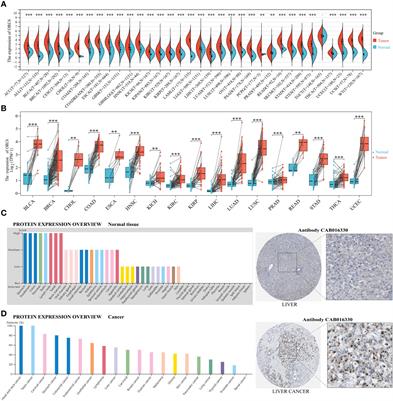 Multi-omics analysis reveals the involvement of origin recognition complex subunit 6 in tumor immune regulation and malignant progression